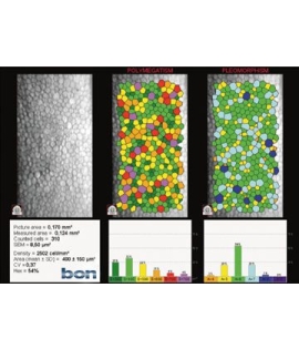 Bon Perseus Specular Microscope