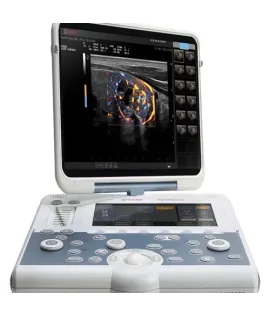 Esaote Mylab Gamma Multipurpose Portable Ultrasound