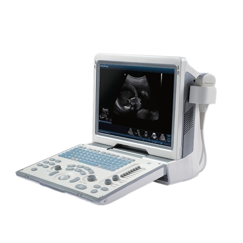 Mindray Dp-50 Portable Ultrasound