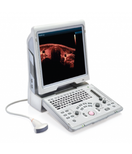 Mindray Z6 Portable Colour Doppler Ultrasound