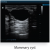 Mindray Z6 Portable Colour Doppler Ultrasound