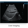 Mindray Z6 Portable Colour Doppler Ultrasound