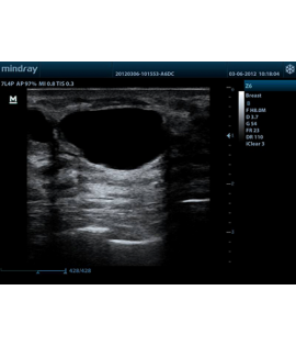 Mindray Z6 Portable Colour Doppler Ultrasound