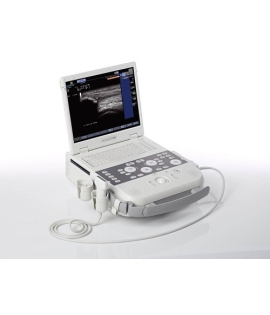 Siemens Acuson P300 Ultrasound