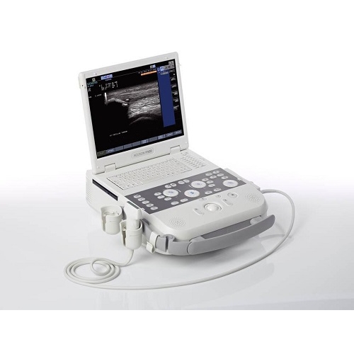 Siemens Acuson P300 Ultrasound Siemens Acuson P300 Ultrasound