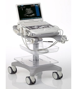 Siemens Acuson P300 Ultrasound